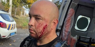 У Павлограді чоловік з ножем напав на поліцейських, одному з них довелося стріляти