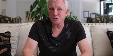 У Британії пенсіонер позбувся товстих щік – і чотири роки не міг заплющити очі