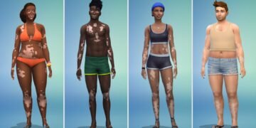 В The Sims 4 добавили персонажей с витилиго