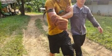 Чоловік замість того, щоб убити ведмедя, відрізав собі руку, аби врятуватись від смерті