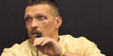 Звернувся до лікарні: Усик показав, як виглядає його обличчя після 111 пропущених ударів у голову від Ф’юрі