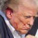 “Услышал свист, выстрелы”, – пуля, пролетевшая в сантиметре от виска Трампа, попала на ФОТО, ВИДЕО