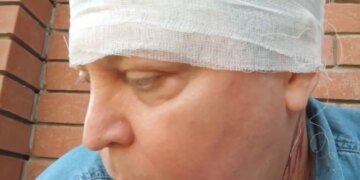 В России подросток разбил битой голову депутату Госдумы. ВИДЕО
