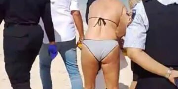 Спробувала сфотографуватися: акула відкусила туристці руки