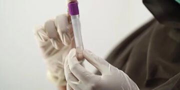 Просто, швидко й ефективно: у Великій Британії розробили аналіз, який допомагає виявити 12 видів раку