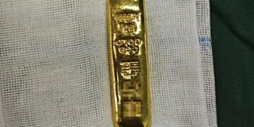 Випадково проковтнув: у шлунку 11-річного хлопчика знайшли золотий злиток