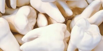 Небезпечний сигнал. Вчені виявили зв’язок між швидкою втратою зубів і ризиком смерті