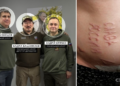 ЗМІ встановили російських хірургів, які випалили “Слава России” на тілі українського полоненого