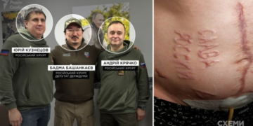 ЗМІ встановили російських хірургів, які випалили “Слава России” на тілі українського полоненого